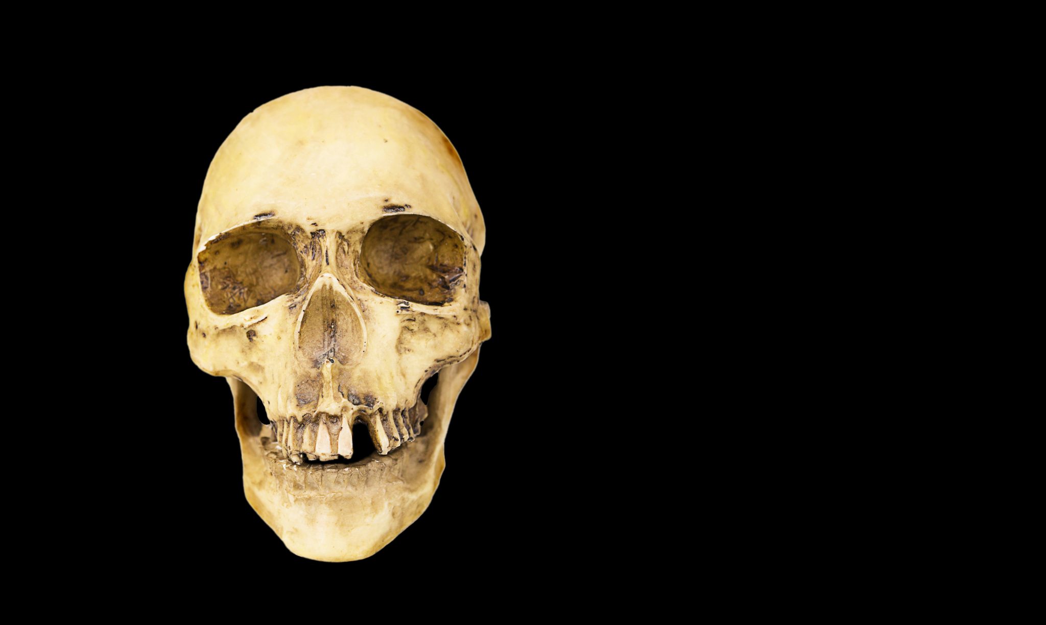 Why Have Humans Gotten Smaller and Weaker Since About 10,000 Years Ago, and What Factors Are Now Reversing That Trend? — Here’s What the Evidence Suggests